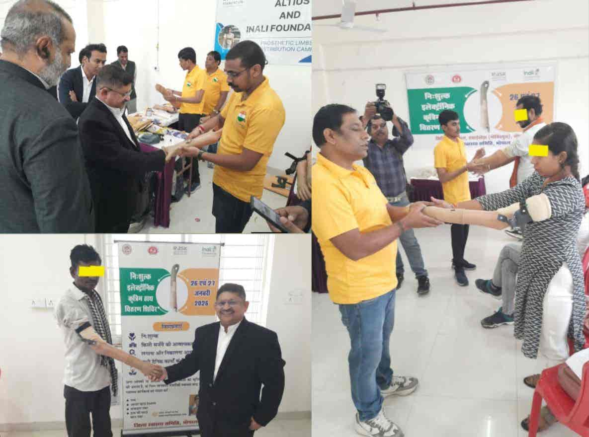 स्वास्थ्यविभाग भोपाल की सार्थक पहल बिना हाथ के दिव्यांगों को लगाए निशुल्क इलेक्ट्रॉनिक प्रोस्थेटिक्स हाथ।