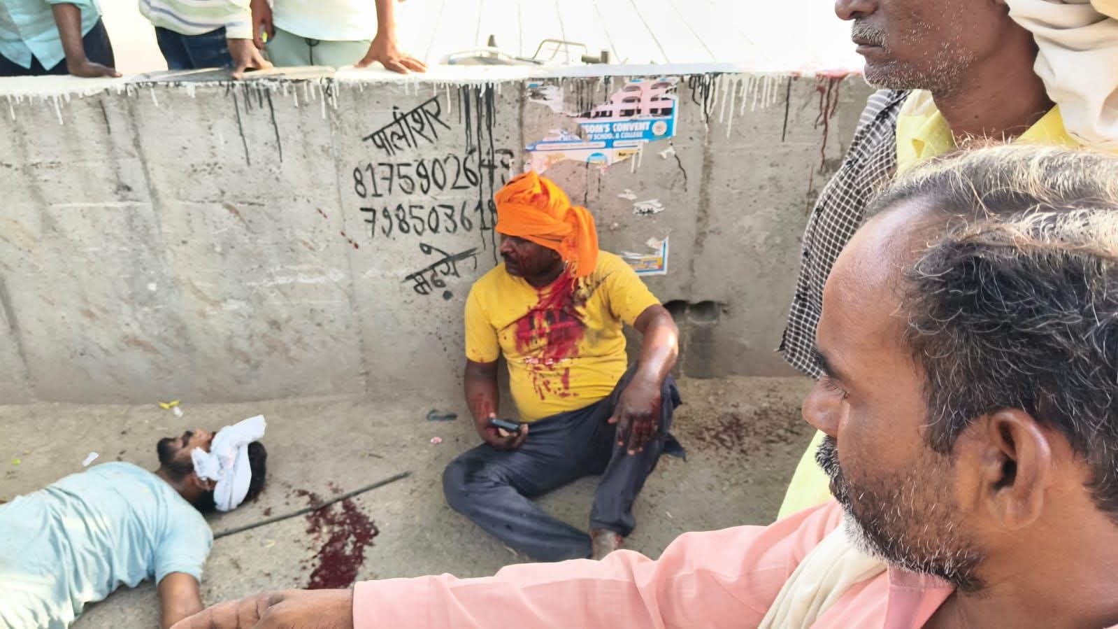 अझुआ ओवरब्रिज का इंतजार पड़ा भारी, एक फिर ट्रक की टक्कर से दो युवक घायल।